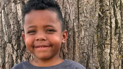  أسمى معاني الإنسانية، معلمة أمريكية تتبرع بجزء من كبدها لتلميذها 