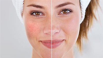 قبل العيد، اجعلى بشرتك مثل الفلتر بمكونات بسيطة 