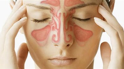  أسباب الإصابة بصداع الجيوب الأنفية.. وطرق تخفيف أعراضه بالمنزل