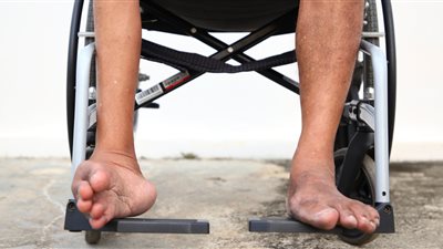 مخاوف من عودة انتشار شلل الأطفال في ليبيا، اعرف التفاصيل 