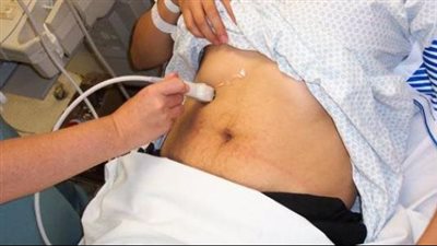 أعراض التهاب المرارة وأسبابه وطرق العلاج والوقاية 