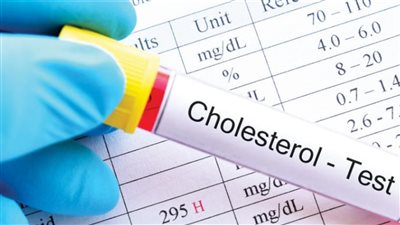 نصائح لمرضى الكوليسترول خلال عيد الأضحى 