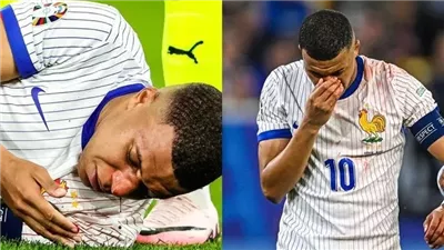 نقل كيليان مبابي إلى المستشفى تمهيدا لخضوعه لعملية جراحية عاجلة (فيديو)