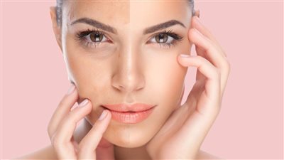 يمكنك صنعها بنفسك، أفضل ماسكات طبيعية لتوحيد لون البشرة في العيد