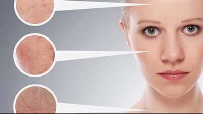 اصنعى بنفسك كريم قبل النوم للبشرة الدهنية واستخدميه يوميا 