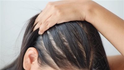 بخاخ سهل وسريع لعلاج فراغات الشعر والقضاء على التساقط نهائيا 