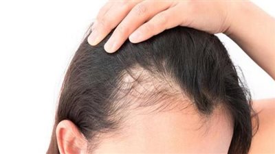 وصفة الروزماري لوقف تساقط الشعر وزيادة كثافته