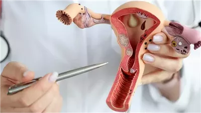  9 أعراض لتكيس المبايض 