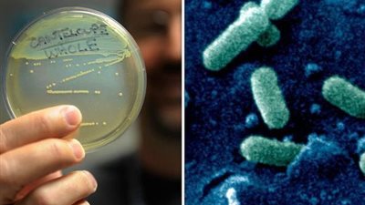 أمريكا تعلن تفشي داء قاتل بـ12 ولاية