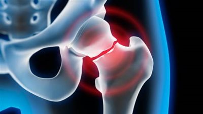 4 أسباب لألم عظام الفخذ، تعرف عليها 