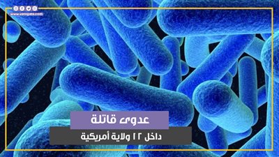 الليستريات.. الولايات المتحدة تعلن تفشي عدوى قاتلة داخل 12 ولاية في وقت واحد (فيديوجراف)