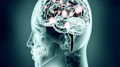 يشبه ريموت كنترول، فريق بحث كوري يطور جهازا للتحكم في العقل عن بعد