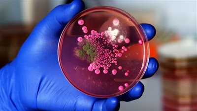 رجل يفقد 22 كيلو من وزنه في وقت قياسي لسبب غير متوقع