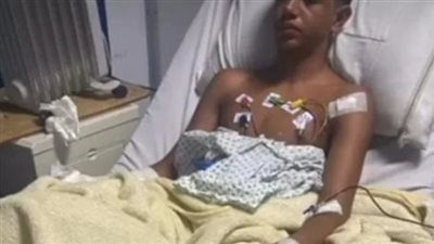 تفاصيل بتر كف سباح على يد بلطجية في الجيزة.. المتهمون اعتدوا عليه بـ «سنجة» على كوبري مشاة.. والداخلية تعلن القبض على الجناة