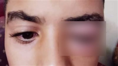 النيابة تباشر التحقيقات في واقعة اتهام معلم بالتعدى على طالب بمدرسة في المعصرة