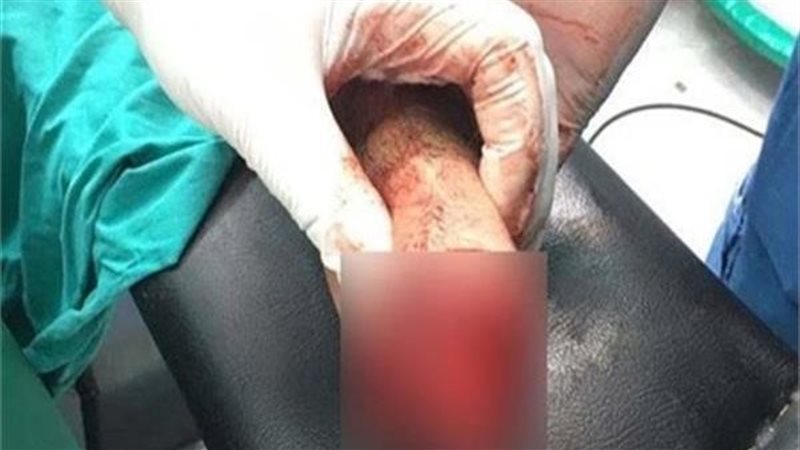 طالب يقطع يد زميله