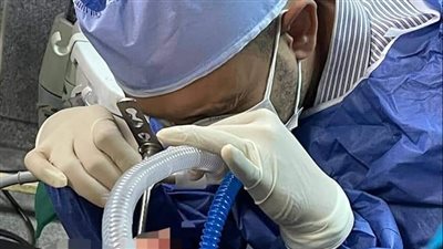 حبة لب دخلت بالقصبة الهوائية.. مستشفى بنها الجامعي ينقذ حياة طفل | صور 