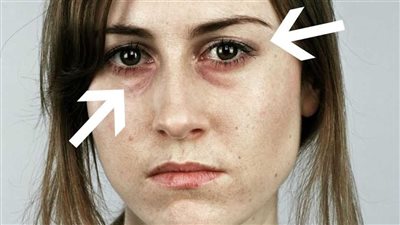 العصير الأحمر لتعزيز نضارة البشرة أثناء الدايت 