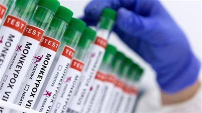 الاتحاد الأفريقي يعلن حالة الطوارئ الصحية بسبب تفشى جدري القرود في القارة