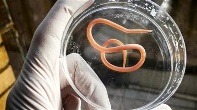 7 طرق طبيعية لعلاج جرثومة المعدة