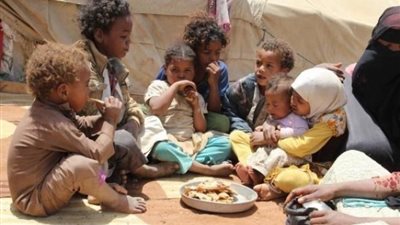 الأمم المتحدة: 600 ألف طفل يعانون من سوء التغذية الحاد باليمن 