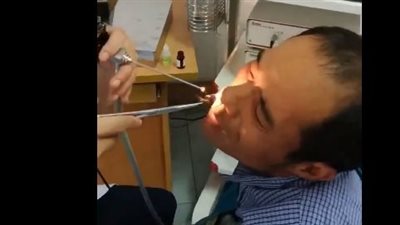 مقطع صادم، لحظة استخراج ثعبان من أنف رجل بعد تناول وجبته المفضلة (فيديو)