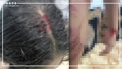 الأجهزة الأمنية تنقذ طفلة وأخواتها من تعذيب عمهم في الفيوم