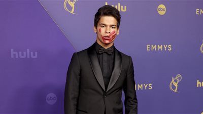  عبر بصمة يد من الدماء على وجهه، دي فاراو وون-ا-تاي يتضامن مع النساء المفقودات في الإيمي (فيديو)