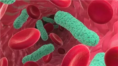 الصحة تحذر من 8 أعراض للإصابة بتسمم الدم