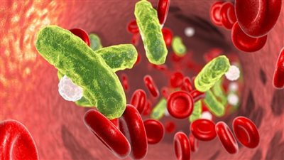 هؤلاء أكثر عرضة للإصابة بتسمم الدم 