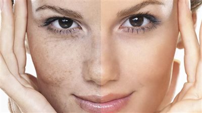 قناع الكاكاو والزبادي لإزالة التصبغات بالبشرة وتفتيحها 