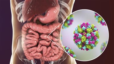 بعد إصابة بعض المواطنين بنزلات معوية بأسوان، أهم أسباب المرض والأعراض ومدة الشفاء