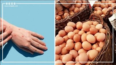 نشرة الأخبار، انخفاض أسعار البيض.. حريق بمعهد الأورام بسوهاج.. دولة عربية تسجل أول إصابة بجدري القرود