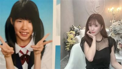 بعد تعرضها للتنمر، يابانية تجري أكثر من 20 عملية تجميل