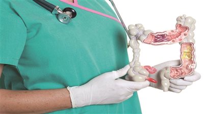 الأعراض الصامتة والشائعة لمرض كرون، ومضاعفاته على الجسم 