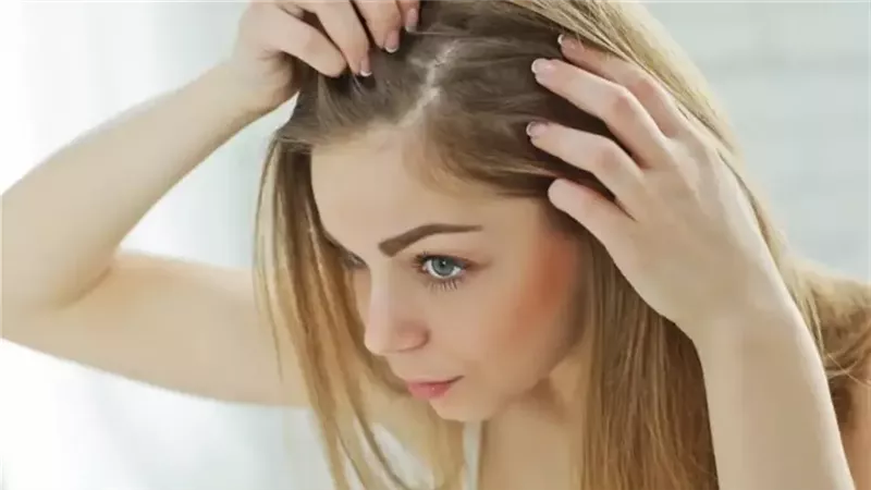 التهاب فروة الرأس،