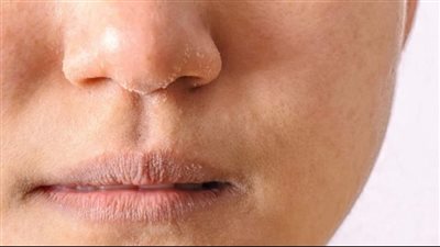 مقشر طبيعي واقتصادي للحفاظ على جمال البشرة الجافة