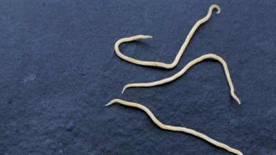  طرق علاج الديدان الدبوسية ونصائح للأطفال المصابين بها 