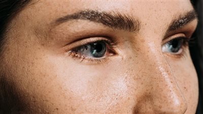 قناع طبيعي يخلصك من النمش ويعزز من نضارة البشرة