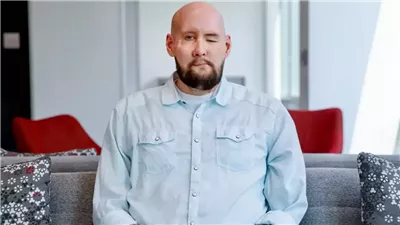  نجاح عملية زرع وجه وعين بالولايات المتحدة