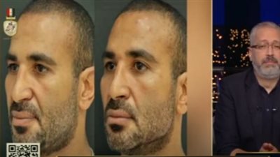 طبيب أحمد سعد يكشف آخر تطورات حالته الصحية بعد العملية (فيديو)