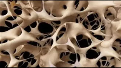 4 نصائح تساعد فى تقوية العظام وتمنع هشاشتها