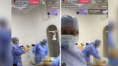 طبيبة تونسية تبث عملية ولادة 