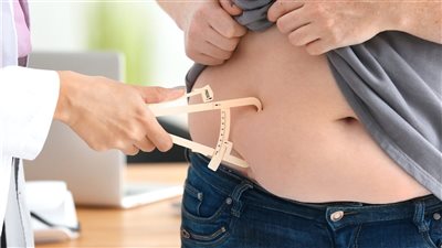 طبيب يكشف خطورة عمليات تكميم المعدة 