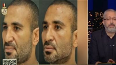 مفاجأة بشأن الحالة الصحية للفنان أحمد سعد 