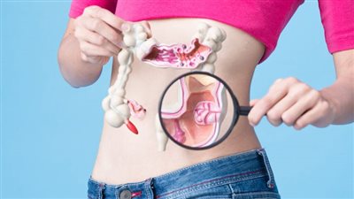 بتتلف الحمض النووي.. دراسة تكشف النظام الغذائي المسبب لسرطان القولون