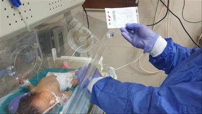 في اليوم العالمي للمبتسرين.. الصحة تكشف أسباب الولادة المبكرة 