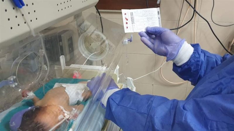 الاطفال المبتسرين