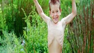 أكلات قدميها لطفلك النحيف لزيادة وزنه