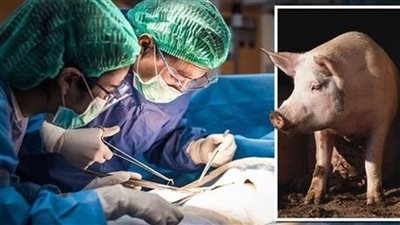 المفتي يكشف حكم التداوي بعضو من أعضاء الخنزير | فيديو